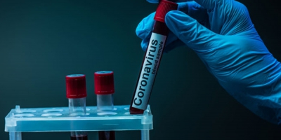 На Тернопільщині підтвердили 69 нових випадків коронавірусу