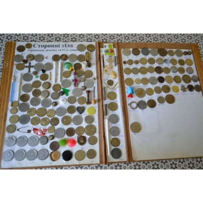 Монети, сережки, батарейки: тернопільські медики показали, що можуть ковтнути діти (фотофакт)