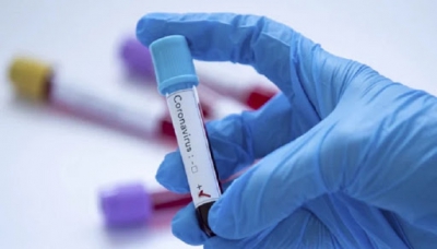 На Тернопільщині за попередню добу не виявили смертей від коронавірусу