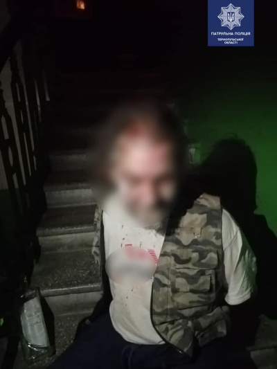 Лежав на сходах з розбитою головою та сильною кровотечею: у Тернополі побили двох чоловіків