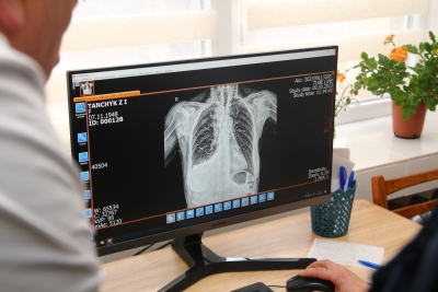 Селищна лікарня на Тернопільщині отримала новий рентгенологічний апарат