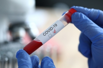 Повідомили кількість пацієнтів з COVID-19, які перебувають у тернопільських лікарнях