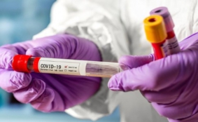 На Тернопільщині виявили ще 40 випадків коронавірусу
