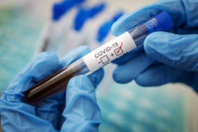 На Тернопільщині коронавірус виявили ще у понад 170-ти людей