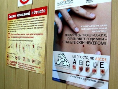 У Тернополі безкоштовно обстежать родимки через ризик раку
