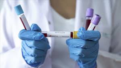 На Тернопільщині - 63 нових випадки інфікування коронавірусом