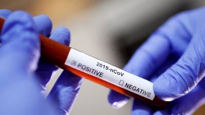 З 10 до 5 днів: в Україні скоротили термін самоізоляції хворих на коронавірус