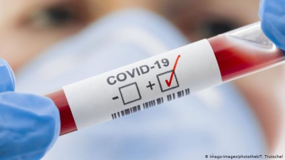 На Тернопільщині - 374 нових випадки інфікування вірусом COVID-19