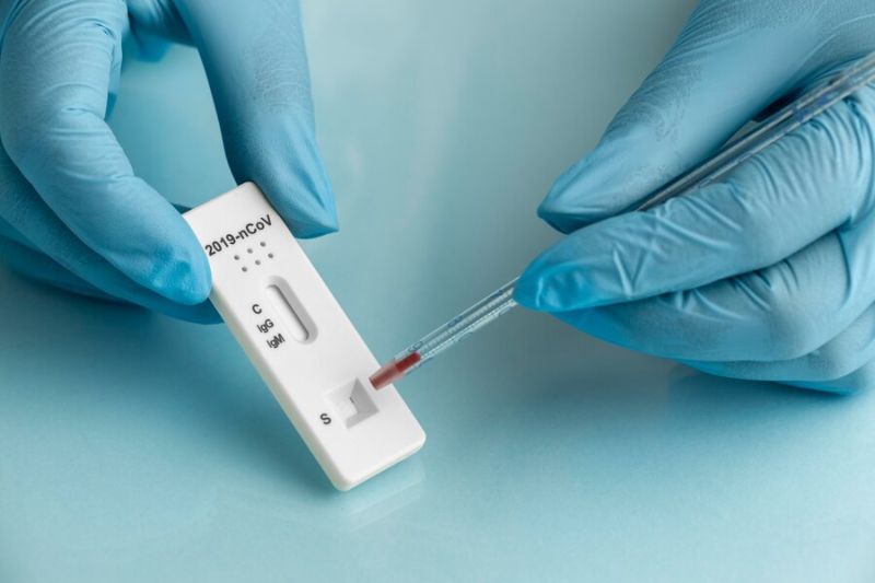 Епідситуація із захворюваності на грип, ГРВІ та COVID-19 на Тернопільщині