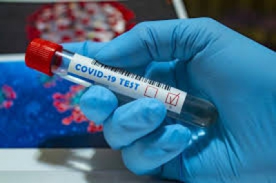 На Тернопільщні - 152 нових випадки інфікування коронавірусом