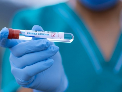 У Тернополі зафіксували 63 нових випадки коронавірусної інфекції