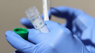 За тиждень на Тернопільщині від коронавірусу померло 45 осіб, одна людина була вакцинована, – епідеміолог