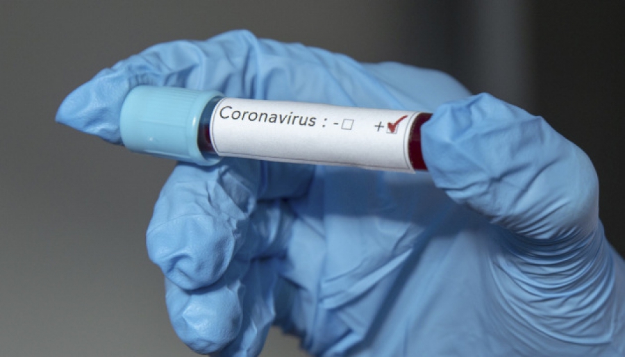 У МОЗ підтвердили перший випадок коронавірусу на Тернопільщині