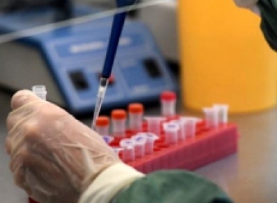 Коронавірус не відтупає: на Тернопільщині - 310 нових випадків інфікування