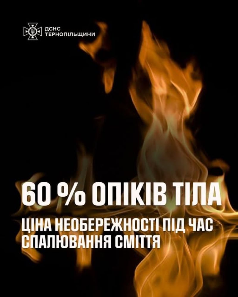 На Тернопільщині жінка, спалюючи сміття, отримала 60% опіків тіла
