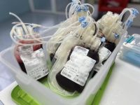 Потрібні донори з негативним резус-фактором: у центрі крові розповіли, яких груп не вистачає