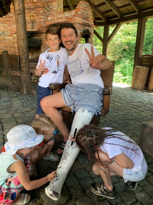 Відомий шоумен з Тернопільщини зламав ногу