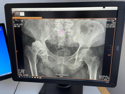 У лікарні на Тернопільщині скоро запрацює новий рентген апарат