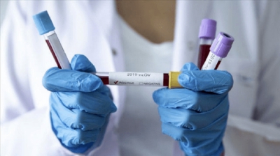 До нового року підйому захворюваності на коронавірус не буде, – тернопільський епідеміолог